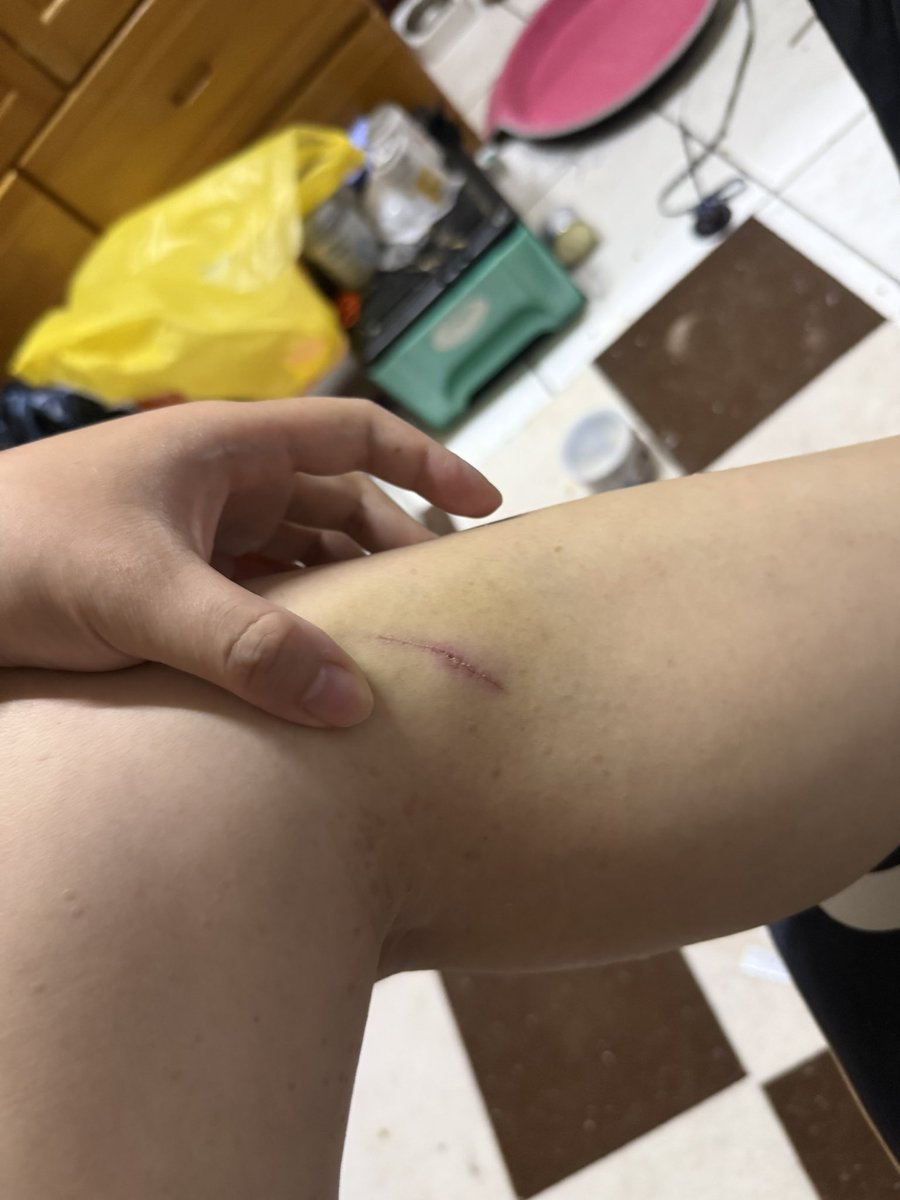 momo554109's tweet photo. 今天又再次被小六餵食小六進步了
他打的好舒服偶爾痛偶爾爽
然後為了彌補上次倒吊沒拍到照片的關係又上去一次結果整個人連吊點摔下來嗚我有烤雞不要黑單我摔一個兩隻腳都有傷手也小擦傷拔辣問我下次還上去嗎我說下次等你修好
我也是心大 https://t.co/Pck9JcwopK