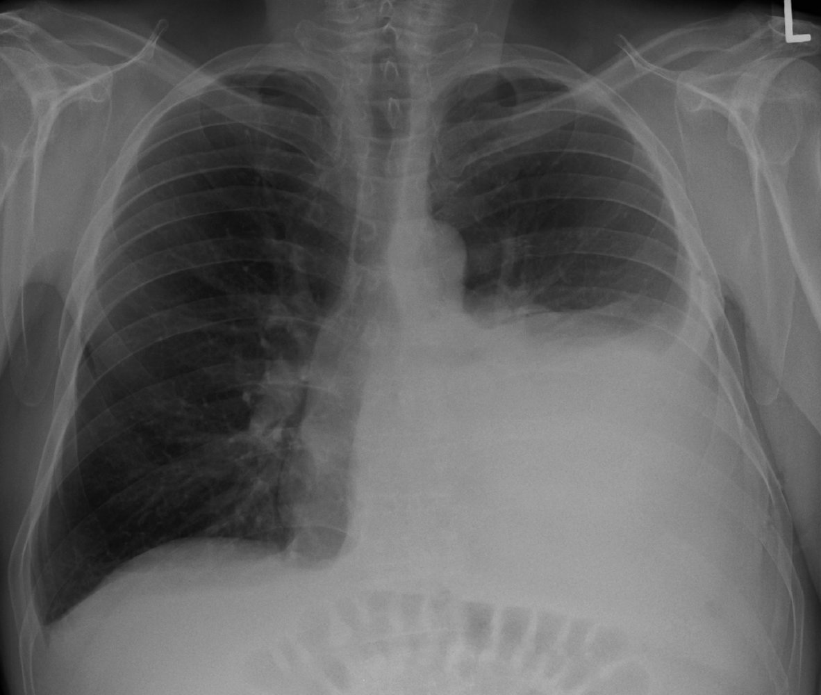 CardiovascularCorner tweet media