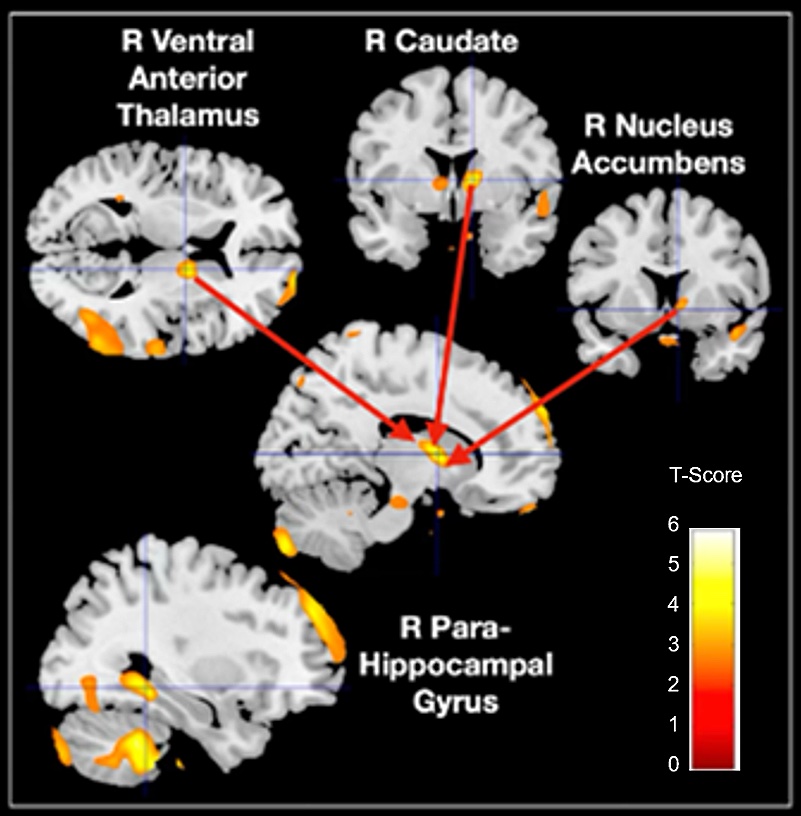 Brain tweet media