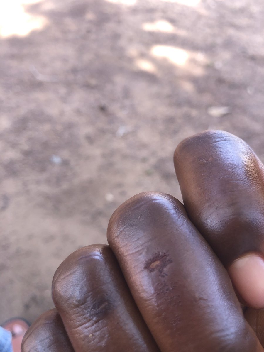 uche_Ezigbo's tweet photo. I have been using viva detergent for the longest I can remember…ran out of it and used another brand and it gave me wound (first time I’m experiencing such)

If I leave Viva @VivaDetergent  again make I dye 😒😒😒 https://t.co/GnR1bjd5yQ