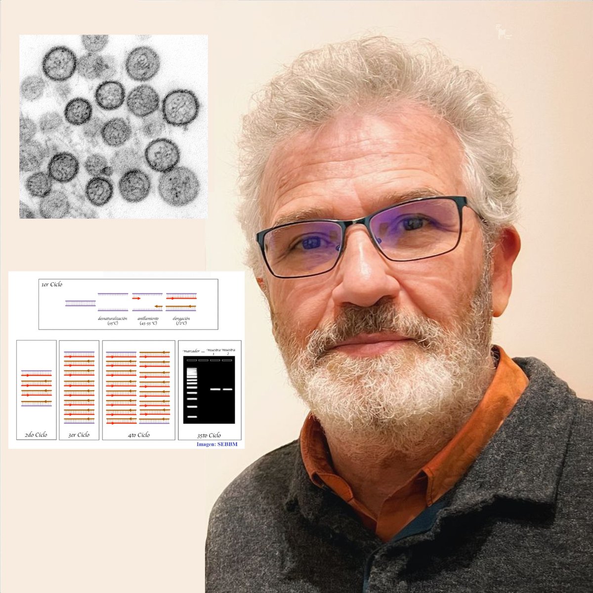 searavalero's tweet photo. El brote de #hantavirus en el crucero MV Hondius ha vuelto a poner de actualidad la PCR. En #Máscerca @Radio5 hemos hablado de su descubrimiento y aplicaciones con José Manuel Bautista @1000genes, catedrático @unicomplutense @SEBBM_es 
https://t.co/pBdDDh9vS6 https://t.co/VQIFUBjEHQ