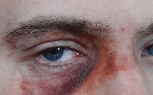 TRENCHKVLT's tweet photo. Revólver, apunta y dispara, recarga. Apunta a matar; no me dejes con vida. Apunta y dispara, recarga, mátame, sin piedad, sin miedo, mátame. Que brote mi sangre, que salga a borbotones, recarga y apunta, que mi roja sangre no te dé miedo, dispara. https://t.co/EUq7diF2na