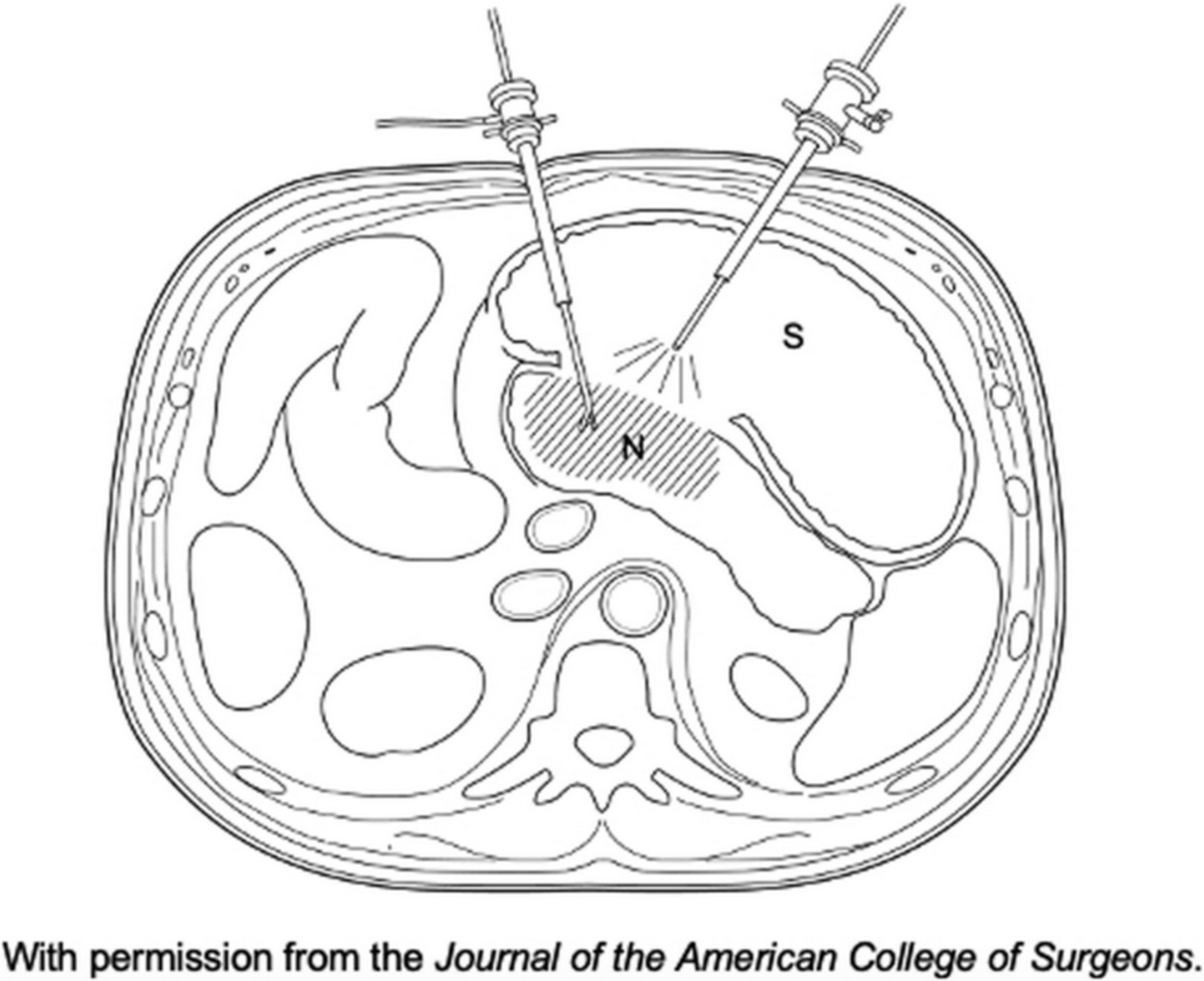 AnnalsofSurgery tweet picture