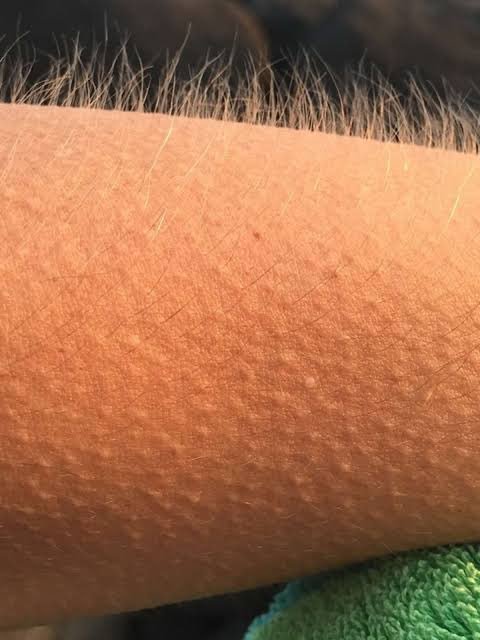 Oscar ✨ tweet media