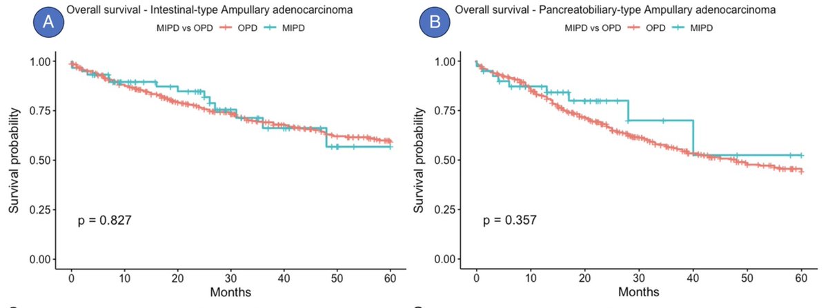 AnnalsofSurgery's tweet photo. In an international multicenter study, minimally invasive and open pancreatoduodenectomy demonstrated comparable oncologic and survival outcomes for both intestinal and pancreatobiliary ampullary adenocarcinoma subtypes. https://t.co/zi4VprA2P8 https://t.co/tqtnHNpdFp