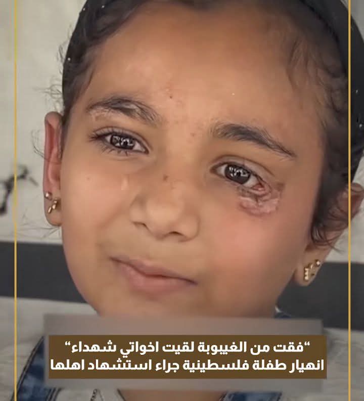han_moh7's tweet photo. ”فاقت من الغيبوبة لقيت اخوتها شهداء” انهيار طفلة فلسطينية جراء استـ ـشهاد أهلها في غـ..ـارة على #غزة ..😱😭💔💔🔻
لا تتجاهل 🥺🥺 من أجل الإنسانية لا تتوقف عن النشر 🙏 والمشاركة.🇵🇸

#انقذوا_اطفال_غزة
 #غزة_تواجه_الإبادة https://t.co/NSOcssFK5q