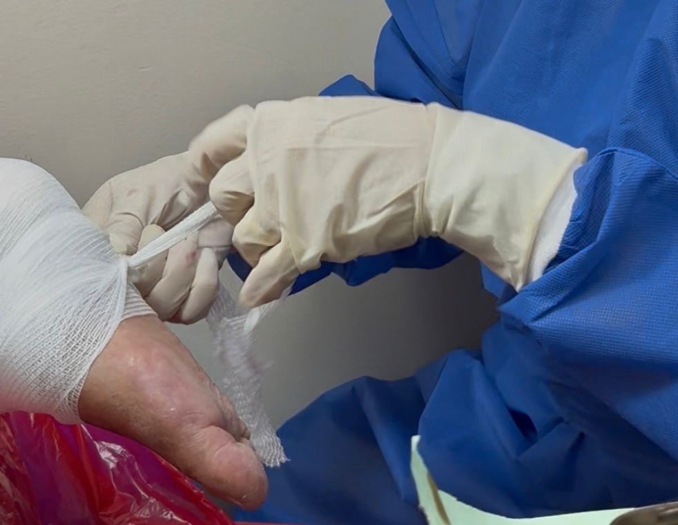 Salud_Guayas's tweet photo. En el Centro de @Salud_Ec N º 7  en #MapasingueEste se refuerza la atención para pacientes con pie diabético.
Si notas:
🔸 Pérdida de sensibilidad
🔸 Heridas que no sanan
🔸 Cambios de color o temperatura

El cuidado de tus pies 🦶 es vital 

#ElNuevoEcuador https://t.co/DfziSKdKel