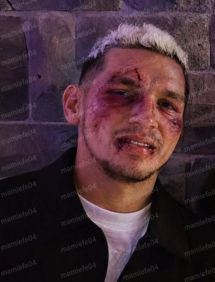 Escándalo en Estambul!!! @LTorreira34 fue agredido en un shopping por un  hombre obsesionado con su pareja, la actriz Devrim Özkan. El volante del  @GalatasaraySK recibió un golpe en el rostro, pero está