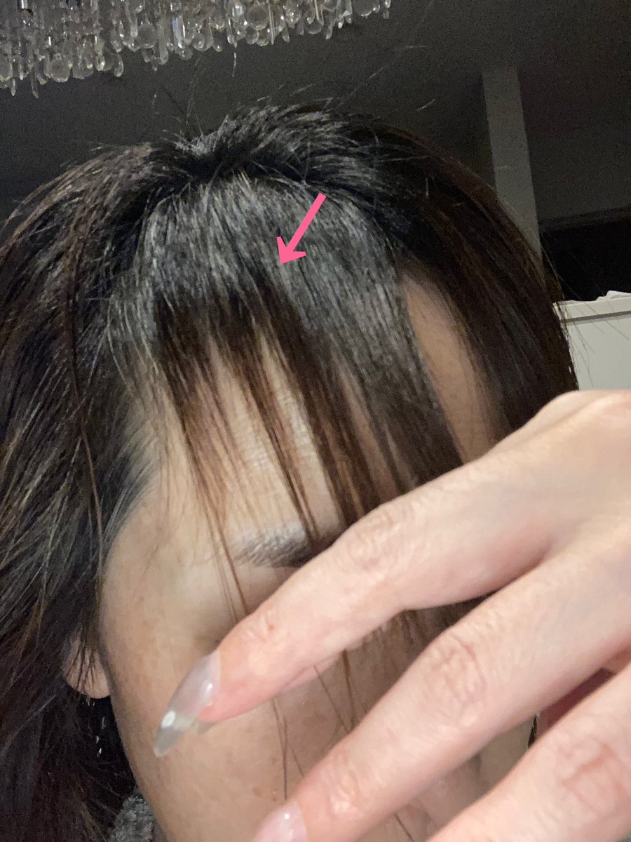 chataseikei's tweet photo. 髪トラブルはずっと継続中😭
一箇所伸びてきたなーと思うと違うところが短くなってる😭
テッペンは常にところどころ穴があるけど気がついたら前髪が😭 https://t.co/ypcX2SJPWw