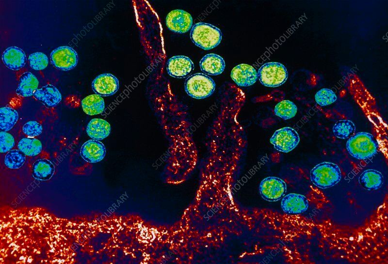 Neuromics's tweet photo. Hantavirus: What You Should Know 
🦠 With hantavirus making headlines recently, many people are hearing about this virus for the first time. 

✅ What Is Hantavirus?
Hantaviruses are a group of viruses carried primarily by rodents. Humans are typically infected by inhaling microscopic particles contaminated with rodent urine, droppings, or saliva. Hantavirus can Cardiopulmonary Syndrome (HCPS), a rapidly progressive disease that affects the lungs and heart. Although infections are uncommon, mortality rates can reach up to 50% in severe cases.

✅ How Contagious Is It?
Most hantaviruses are not transmitted from person to person. The notable exception is Andes virus, found in parts of South America, where limited transmission has been documented among close household contacts.
This means outbreaks usually burn out rather than expand, but individual infections can still be extremely severe.

✅ Early Symptoms:
Symptoms often begin with flu-like signs such as:
- Fever
- Headache
- Muscle aches
- Nausea and vomiting
- Abdominal pain
In some patients, the illness rapidly progresses to shortness of breath, fluid accumulation in the lungs, and respiratory failure, requiring intensive medical care.

✅ Why Hantavirus Matters:
The best protection is minimizing contact with rodents and their waste, especially when cleaning enclosed spaces such as sheds, cabins, and garages.
#Hantavirus #Biology #Immunology