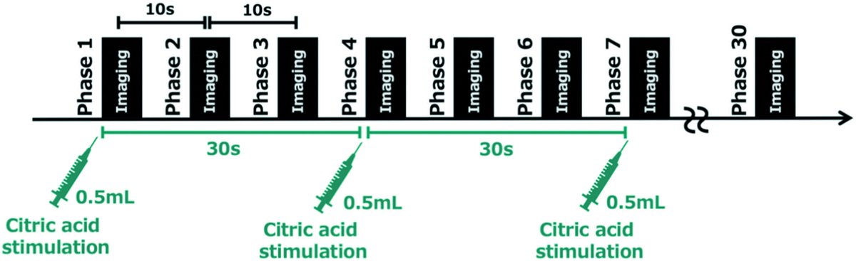 in_magnetic's tweet photo. Advance Publication
A Novel MR Cine Sialography Technique for Evaluating Salivary Gland Function: Correlation with Unstimulated and Stimulated Saliva Volumes https://t.co/DZpxVKeayI https://t.co/26q7Rxlfht