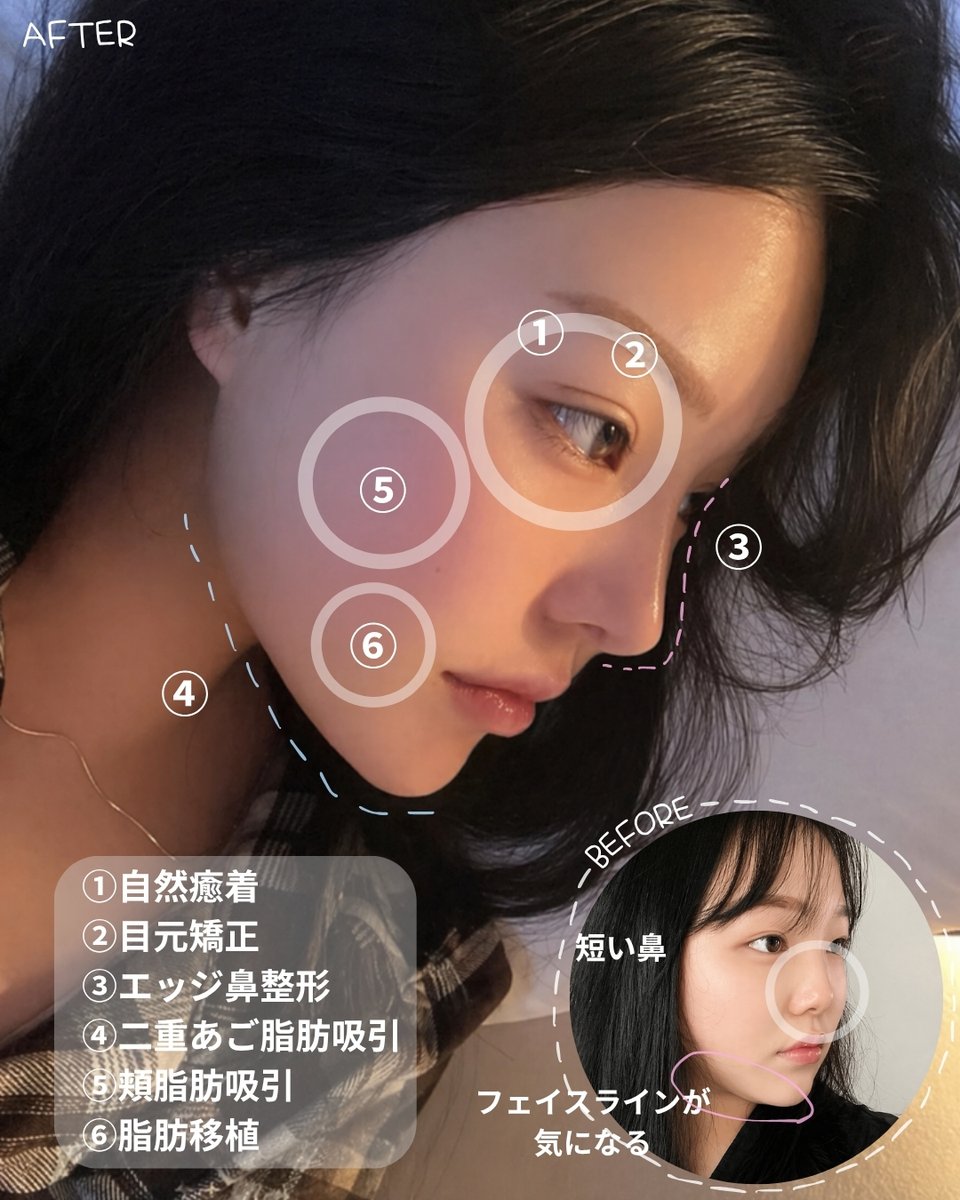 トップフェイス整形外科/目再手術・鼻再手術 tweet media
