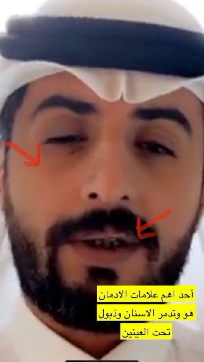 Rami tweet media