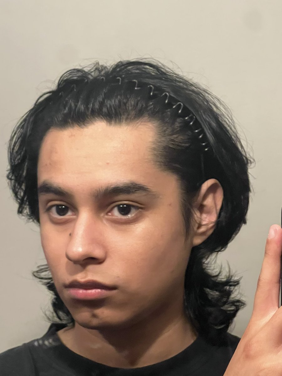 ilyVortexAlt's tweet photo. How does one fix acne. This is horrible :( https://t.co/2oyzzBXzkR