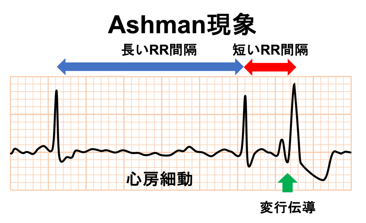 心電図.com tweet media