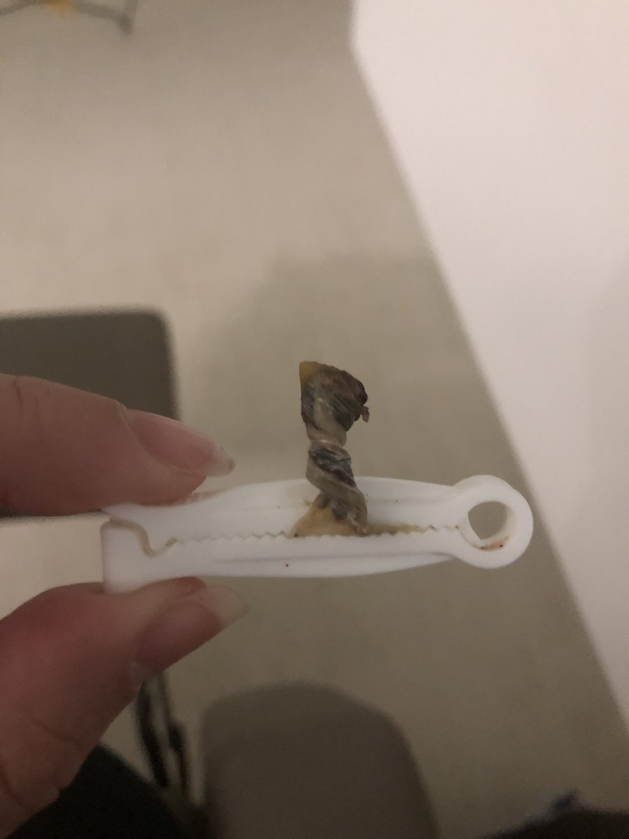 FranEstOchoa's tweet photo. Apenas um dia…
Fui sorteado para caída do umbigo da minha sobrinha
Joelho inchado pois torci (de novo)
Papazinho q minha irmã fez, obg neném 💕
Remedinhos pra manter a mente calma, o corpo sem dor e dormir bem!
Vou 🥱😴 https://t.co/rlCidz1Mff