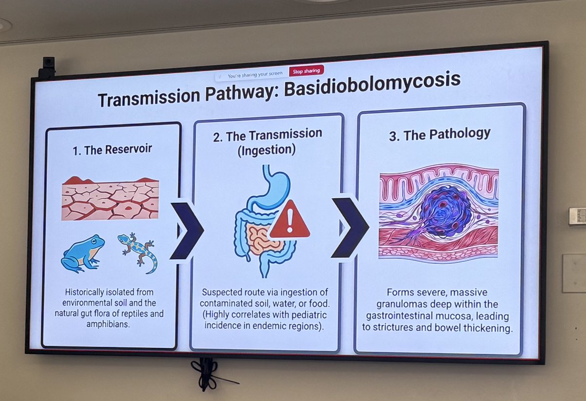 ccf_idfellows's tweet photo. A fascinating dive into the world of desert fungi by transplant ID fellow Dr. Mayyadah Alabdely today at Grand Rounds — from rare neurotropic molds to gastrointestinal basidiobolomycosis. 🌵🍄 #IDTwitter #Mycology https://t.co/E2E2xnkwcZ