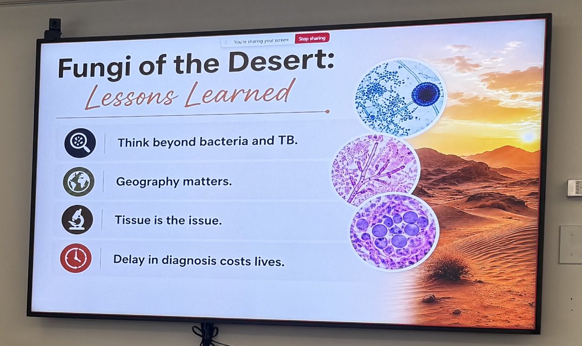 ccf_idfellows's tweet photo. A fascinating dive into the world of desert fungi by transplant ID fellow Dr. Mayyadah Alabdely today at Grand Rounds — from rare neurotropic molds to gastrointestinal basidiobolomycosis. 🌵🍄 #IDTwitter #Mycology https://t.co/E2E2xnkwcZ