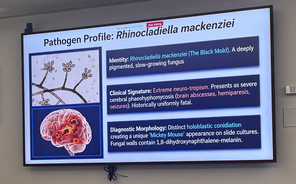ccf_idfellows's tweet photo. A fascinating dive into the world of desert fungi by transplant ID fellow Dr. Mayyadah Alabdely today at Grand Rounds — from rare neurotropic molds to gastrointestinal basidiobolomycosis. 🌵🍄 #IDTwitter #Mycology https://t.co/E2E2xnkwcZ