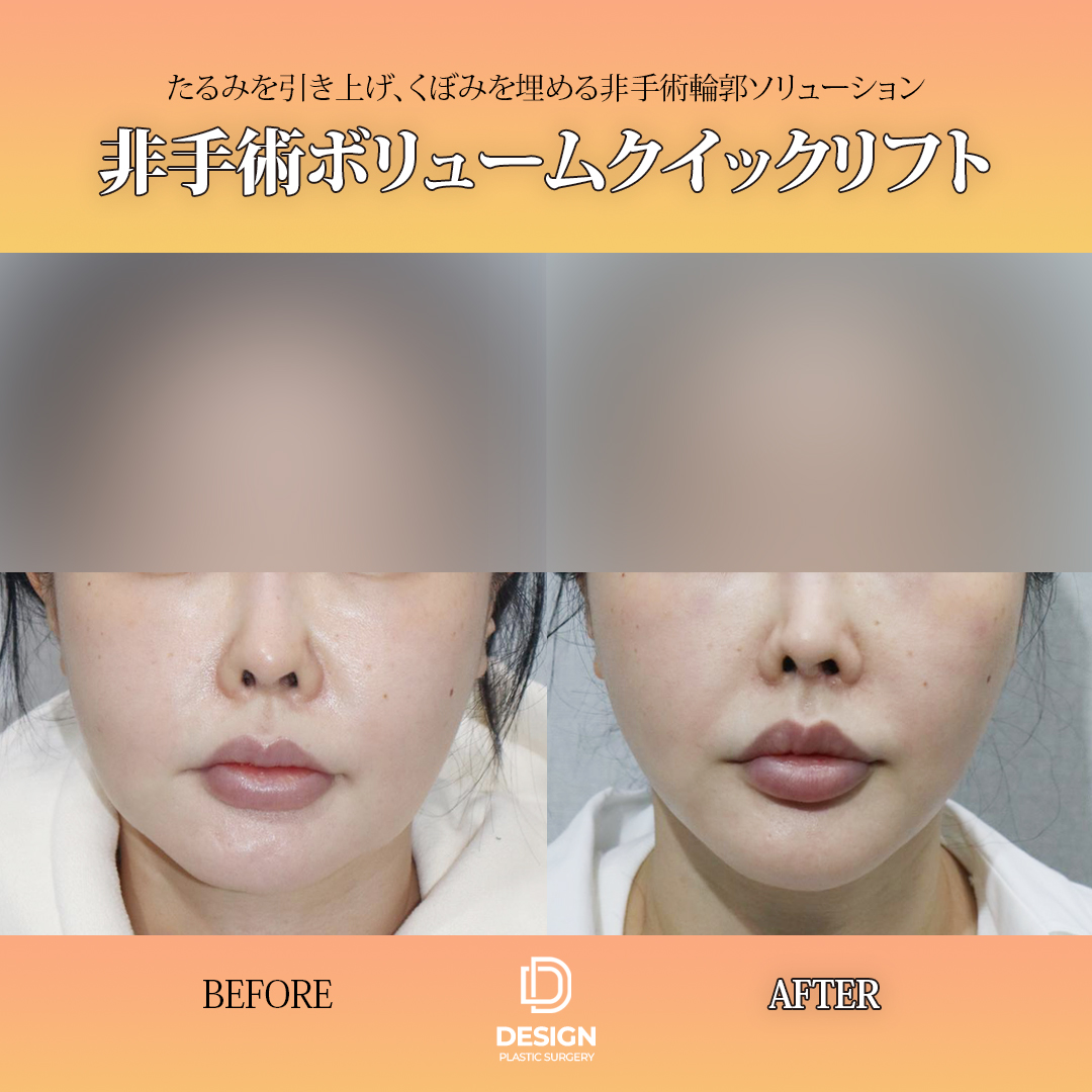 ✨デザイン整形外科【釜山】✨ tweet media