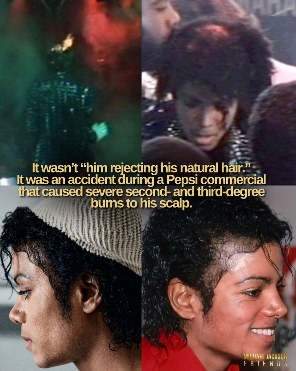 mjfriends_'s tweet photo. 💔 Before judging someone’s appearance, changes, or pain… do your research.

Michael Jackson wasn’t “weird” the way the world portrayed him. There were illnesses, trauma, burns, pressure, constant judgment, and a childhood he never truly got to live.

There was a reason behind everything.

For years, the world turned his suffering into a joke instead of trying to understand the human being behind the fame.

The world owes Michael Jackson an apology.
