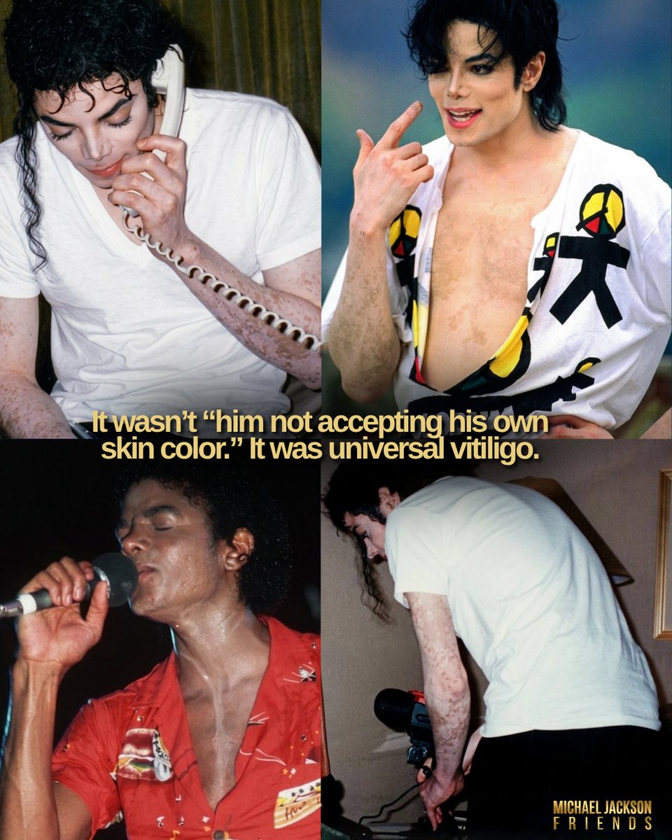 mjfriends_'s tweet photo. 💔 Before judging someone’s appearance, changes, or pain… do your research.

Michael Jackson wasn’t “weird” the way the world portrayed him. There were illnesses, trauma, burns, pressure, constant judgment, and a childhood he never truly got to live.

There was a reason behind everything.

For years, the world turned his suffering into a joke instead of trying to understand the human being behind the fame.

The world owes Michael Jackson an apology.