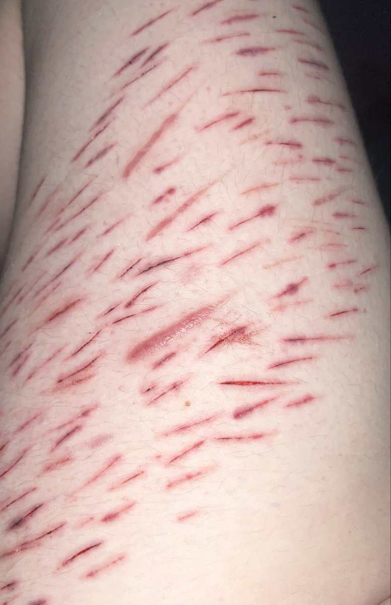 fluffbnnuy's tweet photo. got really carried away when I had an episode.. they hurt like a BITCH (fresh in replies) #slittwt https://t.co/LmkMFc82un