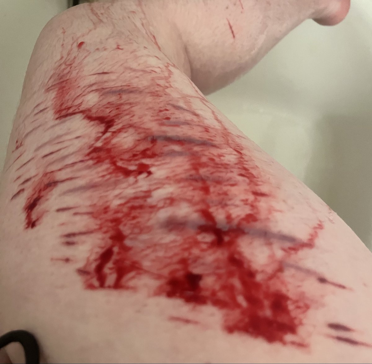 fluffbnnuy's tweet photo. it stinggssss 💔 https://t.co/CPUI5g4aDN