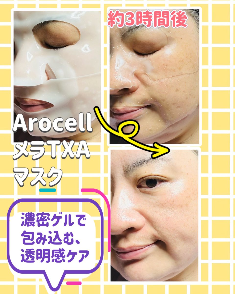 ondinespring221's tweet photo. MORE MEさまを通じて
Arocellさまからいただきました。
Arocell
メラTXAマスク
🫧酸化しやすいピュアビタミンCを含む
さまざまな整肌成分をリポソーム化。
ホワイトカプセルを
ゲルマスクに閉じ込めた処方✨
澄んだ肌印象へ🌙
【PR】
#Arocell #アロセル #韓国コスメ #ゲルマスク #マスクパック https://t.co/QpMzuXof3E
