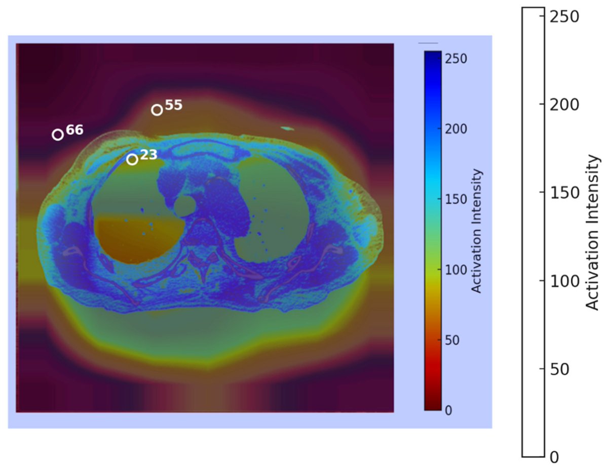 MAKE_MDPI's tweet photo. 🔥 Highly Cited Paper from MAKE
📝 Advancing AI Interpretability in Medical Imaging: A Comparative Analysis of Pixel-Level Interpretability and Grad-CAM Models
🔗 Read more: https://t.co/P63QzvynzN
#AIInterpretability #PLI #GradCAM #MedicalImaging #DeepLearning https://t.co/nsDyJEFYlK
