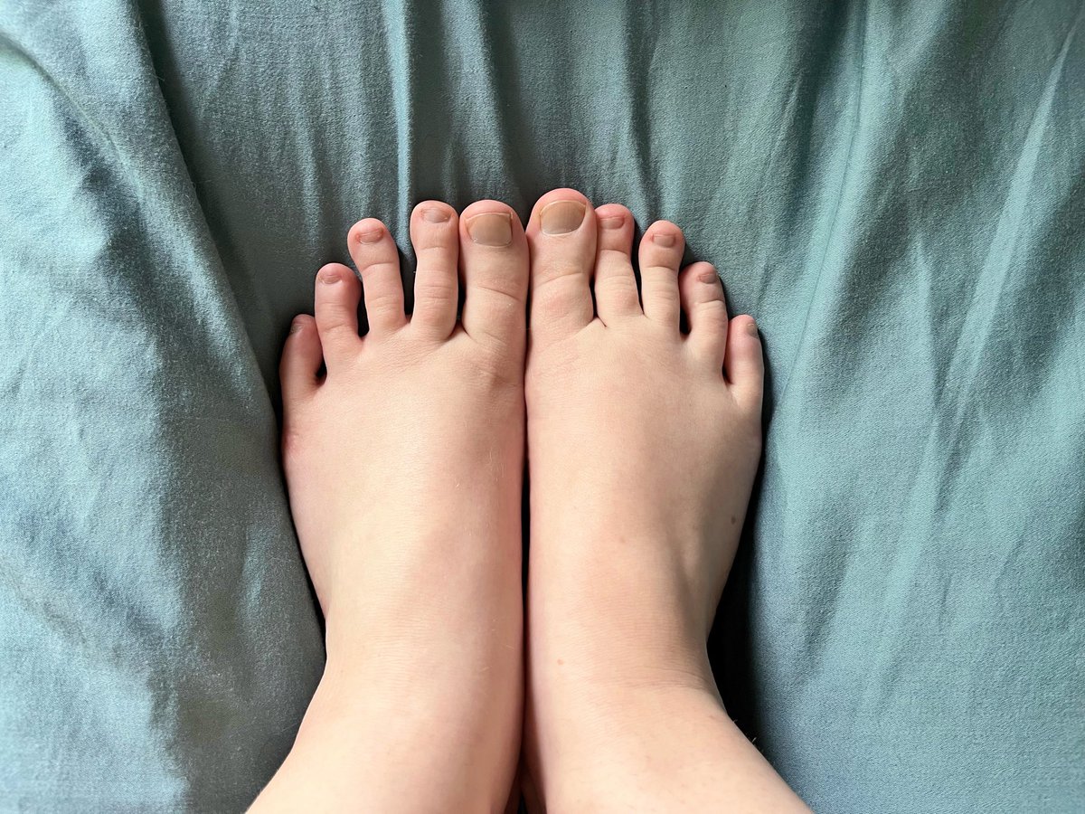 LadyRaspberry05's tweet photo. In desperate need of a pedi, what color should I get next? https://t.co/8a9qsVP4cE