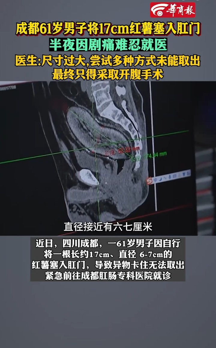 传奇出生乌鲁鲁(巡飞弹只飞别人浮木) tweet media