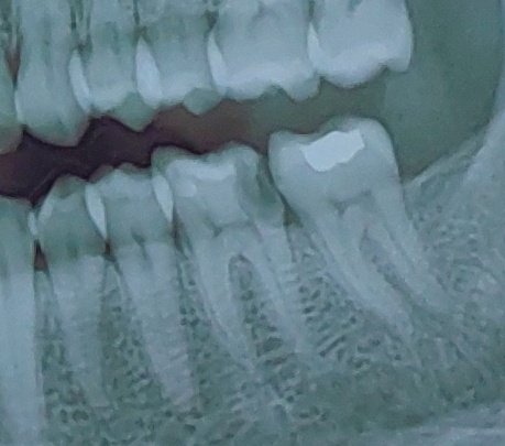 Ali Mirzaei DDS tweet media