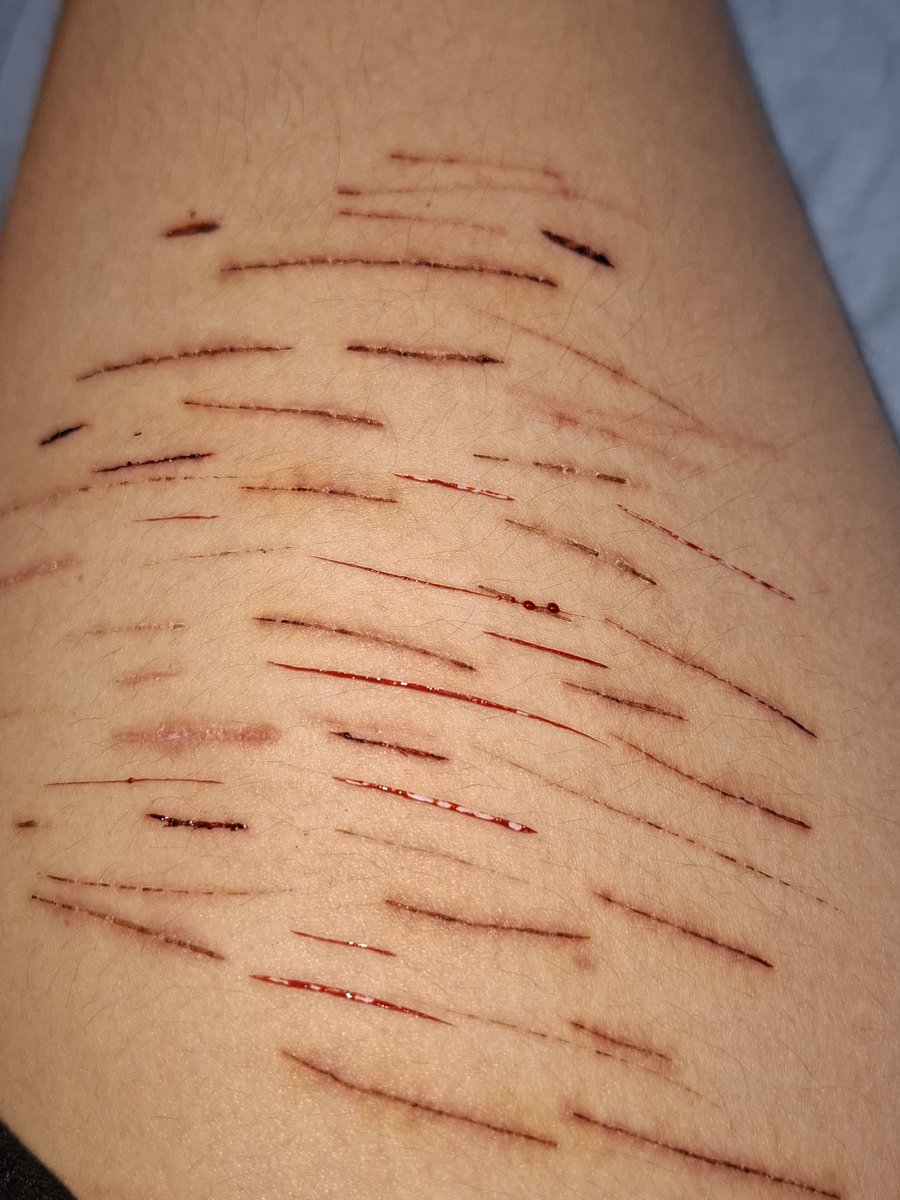 rᥙძ᥆ ᥆𝖿 sһ𝗍ᥕ𝗍🚯 tweet media
