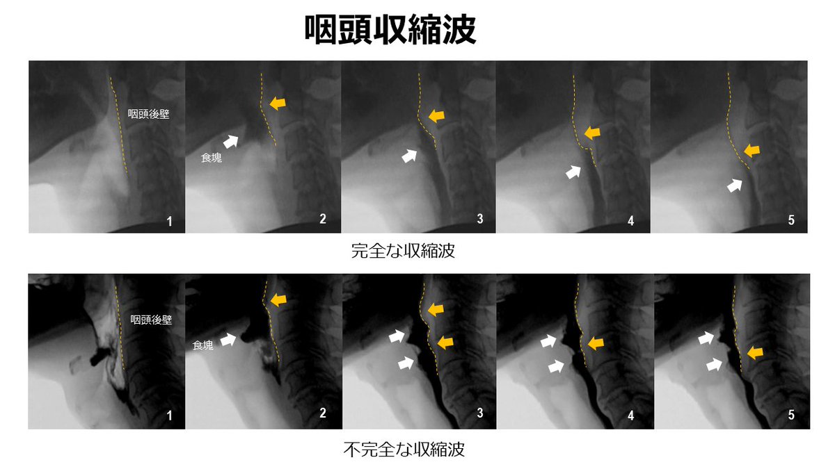 リハノメ|PT・OT・STのための配信動画サービス tweet media
