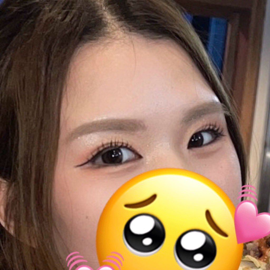 0pan0chu's tweet photo. @answerpsjp 

アンサー美容外科でワンダー切開をして3ヶ月が経過しました。
施術した事を忘れるほど皮膚に違和感もなく自然に目元がスッキリしたように思います https://t.co/zHhoLjgKtK