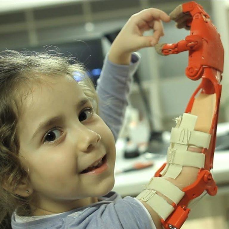 drifbolt's tweet photo. A 3D printed prosthetic hand costs around $100 and takes a day to make. Compare to thousands of dollars and months of waiting for a traditional one. Wild how fast this technology went from concept to actually changing kids" lives. That's what good technology should do.
#drifbolt https://t.co/mixJG91rgz