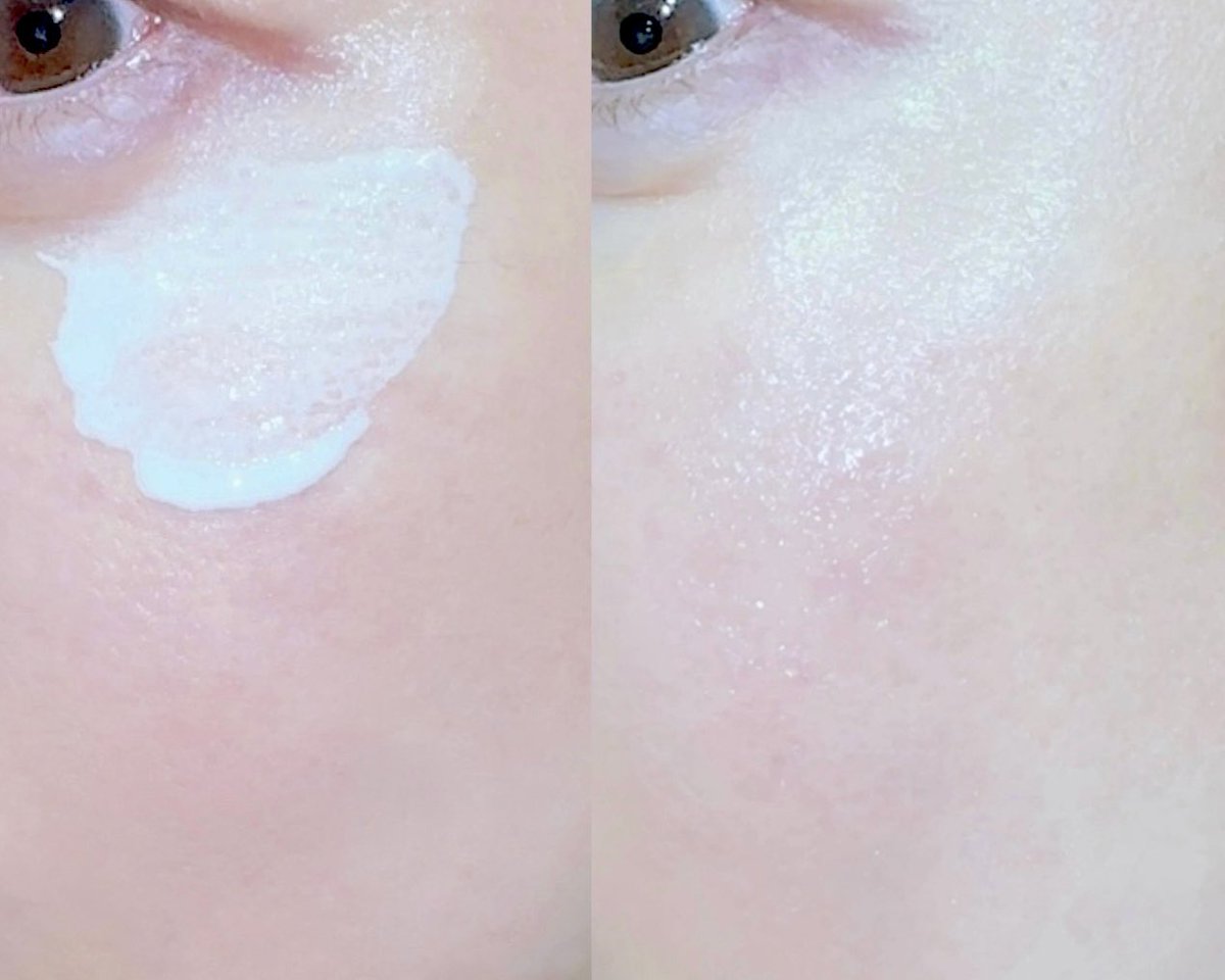 RlhEIv0lS_IYlqZ's tweet photo. 美容医療後やA反応でてると何使ってもしみない？スキンケア迷子になりがちな肌管理勢もケアセラの先行乳液って手があるよ。8種類の天然ヒト型セラミド配合。赤みが気になるダウンタイム中も乾燥から守る。体のシミ取り後はやさしい泡のボディウォッシュ、全身保湿シリーズも重宝した【PR】【ケアセラ】 https://t.co/UdzxiirWyl