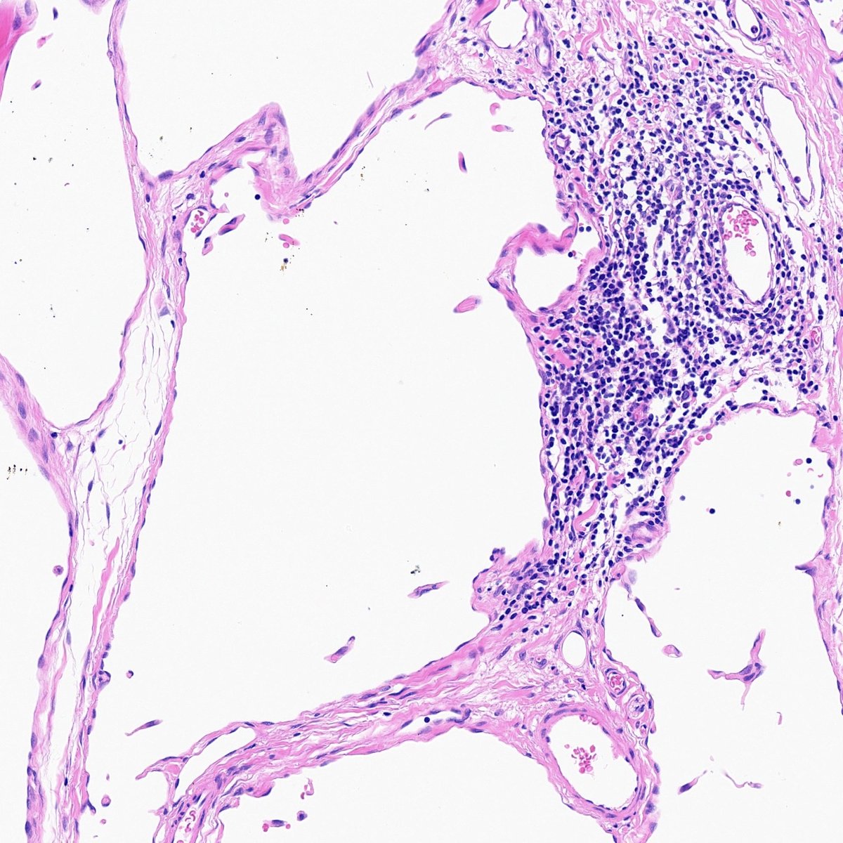 surgpathcases's tweet photo. Neck, 5y

#pathology #patologia #pedipath #bstpath https://t.co/q9PW4HNBmE