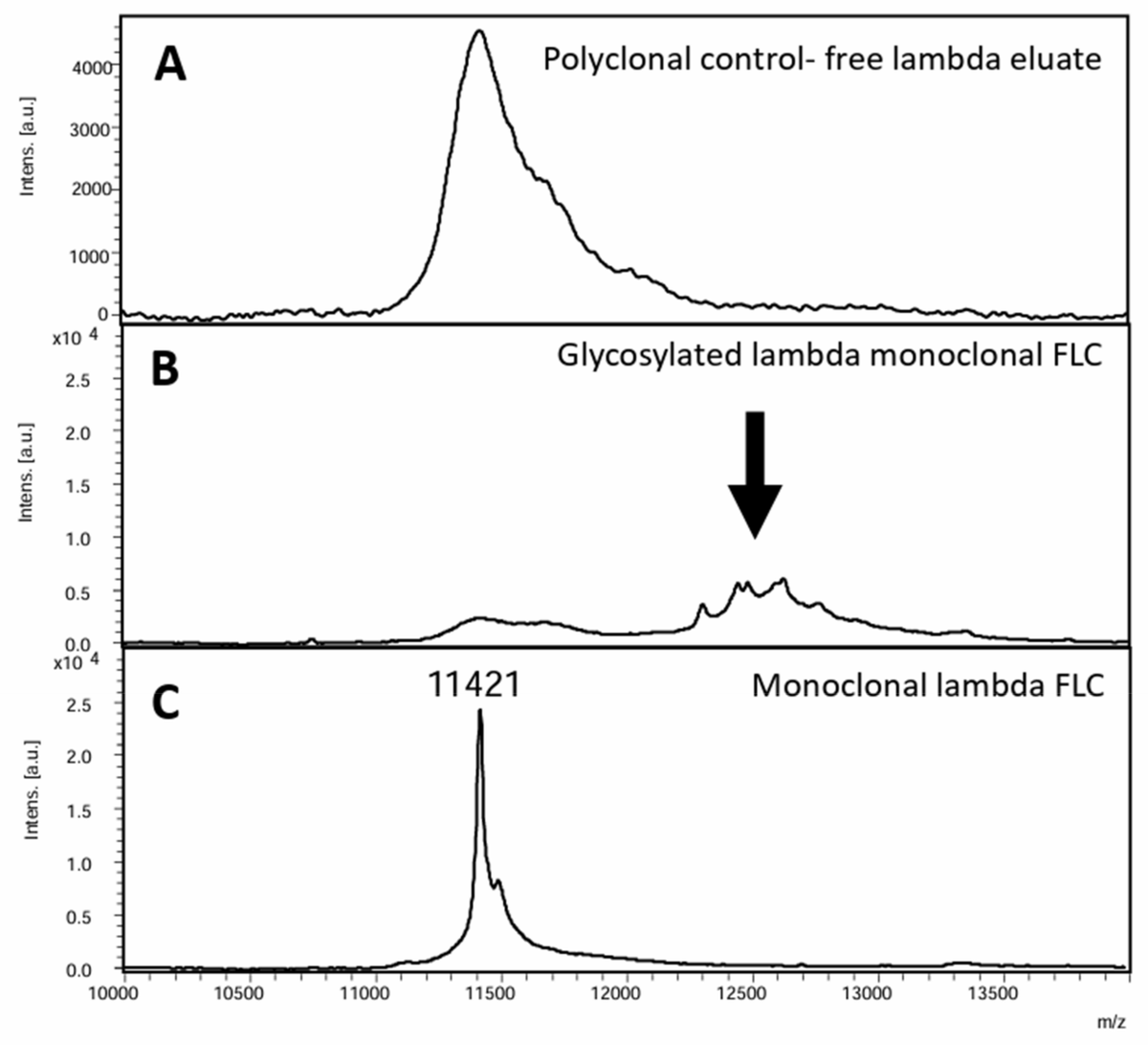 Antibodies_MDPI's tweet photo. Glad to share this paper @MediPharma_MDPI 
 
"Performance #Characteristics and #Limitations of the Available Assays for  the Detection and Quantitation of Monoclonal Free Light Chains and New  Emerging #Methodologies" 
 
https://t.co/Pif5gvPT6P https://t.co/zmDEzaLhzr