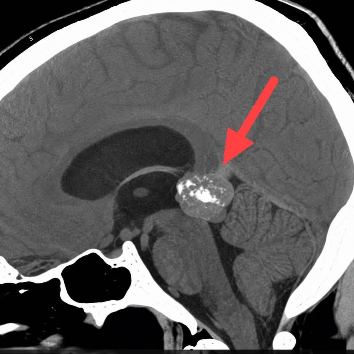 RADIOLOGISTS tweet media