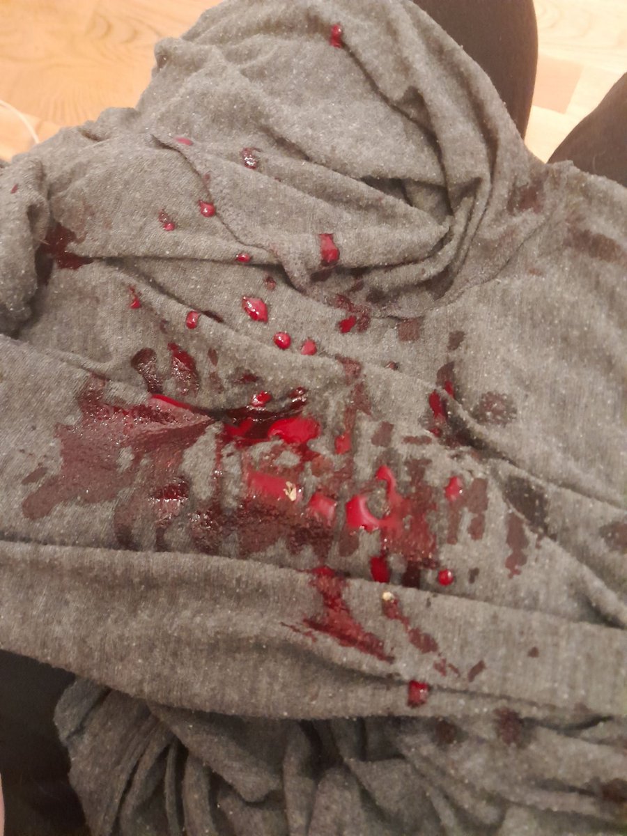 nocalstae's tweet photo. TW blood.
the type of shit I used to take pics of in my eyes only. https://t.co/hVBDJLkXlz