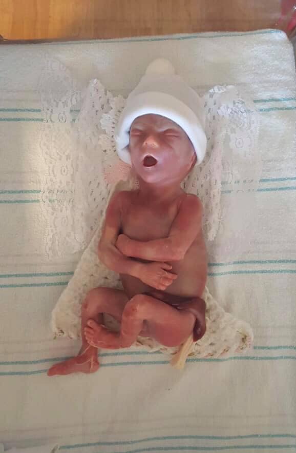 LiveAction's tweet photo. Cayden was stillborn at 24 weeks.

Her mother felt compelled to share her photos to show the humanity of babies her age.

Doctors are performing late-term abortions on babies like Cayden.

Sometimes even older.

Their lives are just as valuable as hers.

Ban abortion now. https://t.co/yGBoala55p