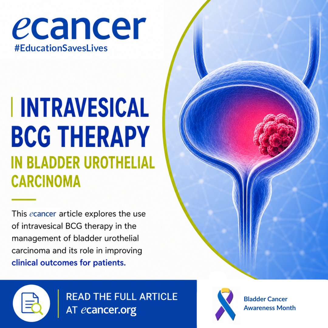 ecancer_espanol's tweet photo. As part of Bladder Cancer Awareness Month, explore this @ecancer article on the use of intravesical BCG in urothelial carcinoma of the bladder.
Read more at https://t.co/7MahUjqzuo 
#BladderCancer #Oncology #CancerResearch #ecancer https://t.co/wayhLdm7qo