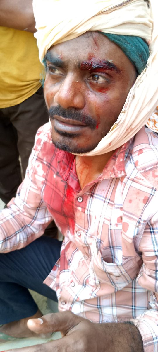 Sabirkhan__'s tweet photo. थाना  क्षेत्र के भखौरा माफी निवासी अमीन खान को मारपीट कर गंभीर रूप से घायल कर लहूलुहान कर दिया गया। मेडिकल होने के 6 घंटे बाद भी अभी तक FIR दर्ज नहीं हुई।

प्रशासन से मांग है कि तत्काल मुकदमा दर्ज कर दोषियों पर सख्त कार्रवाई की जाए।
@Uppolice @bahraichpolice @myogiadityanath https://t.co/O7o5a5N0uQ