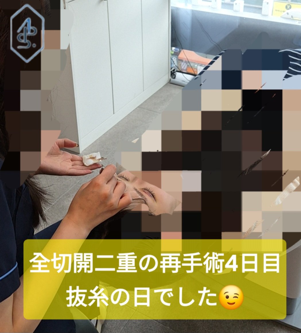 韓国🇰🇷〚目専門〛ドクターアン整形外科 アンビョンジュン整形外科 tweet media