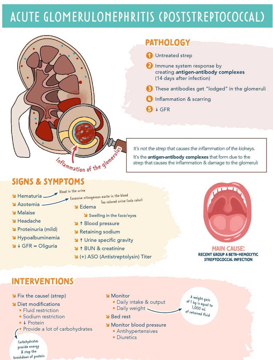 AB_drmd's tweet photo. ✅الـ Post-Streptococcal Glomerulonephritis أو اختصاراً PSGN هو التهاب في كبيبات الكلى Glomeruli يحصل كمضاعفة مناعية بعد إصابة ببكتيريا اسمها Group A Beta-Hemolytic Streptococcus أو اختصاراً GAS، وأهم شي تفهمه من البداية إن الكلى ما أصابها البكتيريا مباشرة، بل اللي صار هو إن جهاز المناعة حارب البكتيريا وكوّن Antibodies ضدها، وهذه الـ Antibodies اتحدت مع مستضدات البكتيريا وكونت مجمعات اسمها Immune Complexes، وهذه المجمعات ترسبت في الـ Glomeruli وسببت التهاب شديد فيها، وهذي الآلية تُسمى Type III Hypersensitivity Reaction.

الإصابة بالبكتيريا اللي تسبق المرض ممكن تكون على شكلين، إما Streptococcal Pharyngitis يعني التهاب الحلق وبعده بـ 1-3 أسابيع تظهر أعراض الكلى، أو Streptococcal Skin Infection يعني Impetigo وبعده بـ 3-6 أسابيع تظهر الأعراض، والفرق في المدة مهم تحفظه، أما من ناحية من يصيب فهو أكثر شيوعاً عند الأطفال بين عمر 5-12 سنة والذكور أكثر من الإناث.

أعراضه الكلاسيكية تجي على شكل Nephritic Syndrome اللي يتكون من أربع أعراض رئيسية، أولها Hematuria يعني دم في البول واللي يكون إما مجهري أو ظاهر بالعين المجردة ولونه بني غامق يشبه لون الكولا أو مياه غسيل اللحم وهذي علامة مميزة جداً، وثانيها Hypertension يعني ارتفاع ضغط الدم بسبب احتباس الصوديوم والماء، وثالثها Edema خصوصاً حول العيون Periorbital Edema صباحاً وفي الأطراف السفلية، ورابعها Oliguria يعني نقص كمية البول، ومن ناحية التشخيص تحتاج عدة فحوصات، فحص البول Urinalysis يظهر RBC Casts وهي علامة مميزة جداً تدل على إن النزيف جاي من الـ Glomeruli نفسها، وكمان Proteinuria بس عادةً خفيفة مو مثل الـ Nephrotic Syndrome، وفحوصات الدم تظهر ارتفاع في Creatinine وBUN دلالة على تأثر وظيفة الكلى، وأهم الفحوصات المناعية هي ارتفاع ASO Titer يعني Anti-Streptolysin O وهو دليل على إصابة سابقة بالـ Streptococcus، وكمان انخفاض مستوى C3 Complement مع C4 طبيعي وهذي نقطة مهمة تميزه عن أمراض كلوية أخرى.

أما العلاج فما فيه علاج نوعي للمرض نفسه لأنه في الغالب يتحسن لوحده Self-Limiting، بس العلاج يكون Supportive يعني تعطيه Antihypertensives لو الضغط مرتفع، وتقلل الملح والماء في الأكل لتقليل الـ Edema، وتعطيه Diuretics مثل Furosemide ل�� فيه احتباس سوائل شديد، وتعطيه Antibiotics مثل Penicillin مو عشان يعالج الكلى بل عشان تقضي على أي بكتيريا باقية وتمنع انتشارها لأشخاص ثانيين، والبشرى الحلوة إن تشخيص PSGN عند الأطفال ممتاز جداً، أكثر من 95% يتعافون بشكل كامل خلال أسابيع إلى أشهر، بس عند البالغين الوضع أقل تفاؤلاً وبعضهم يطور Chronic Kidney Disease، لذلك المتابعة مهمة حتى بعد ما تتحسن الأعراض.