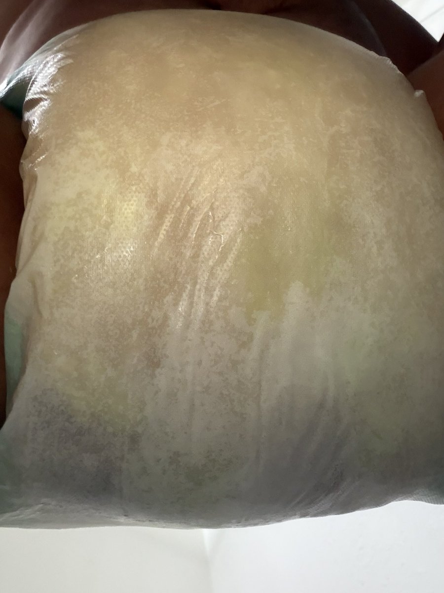 Skull Boi Laz (DIAPERED, STINKY) tweet media