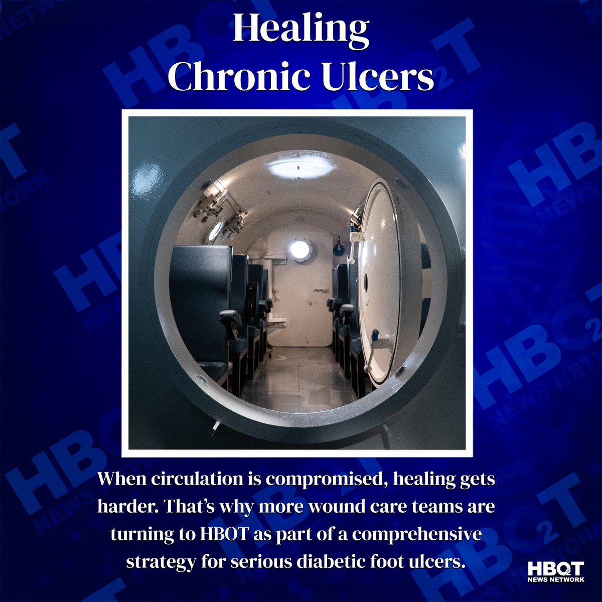 NewsHbot's tweet photo. Non-healing wounds are no joke. HBOT is helping change diabetic wound care by delivering oxygen where the body needs it most supporting healing and limb preservation for many patients. 

Learn More: https://t.co/vCT4kneOSC https://t.co/wWaGmSwHXq