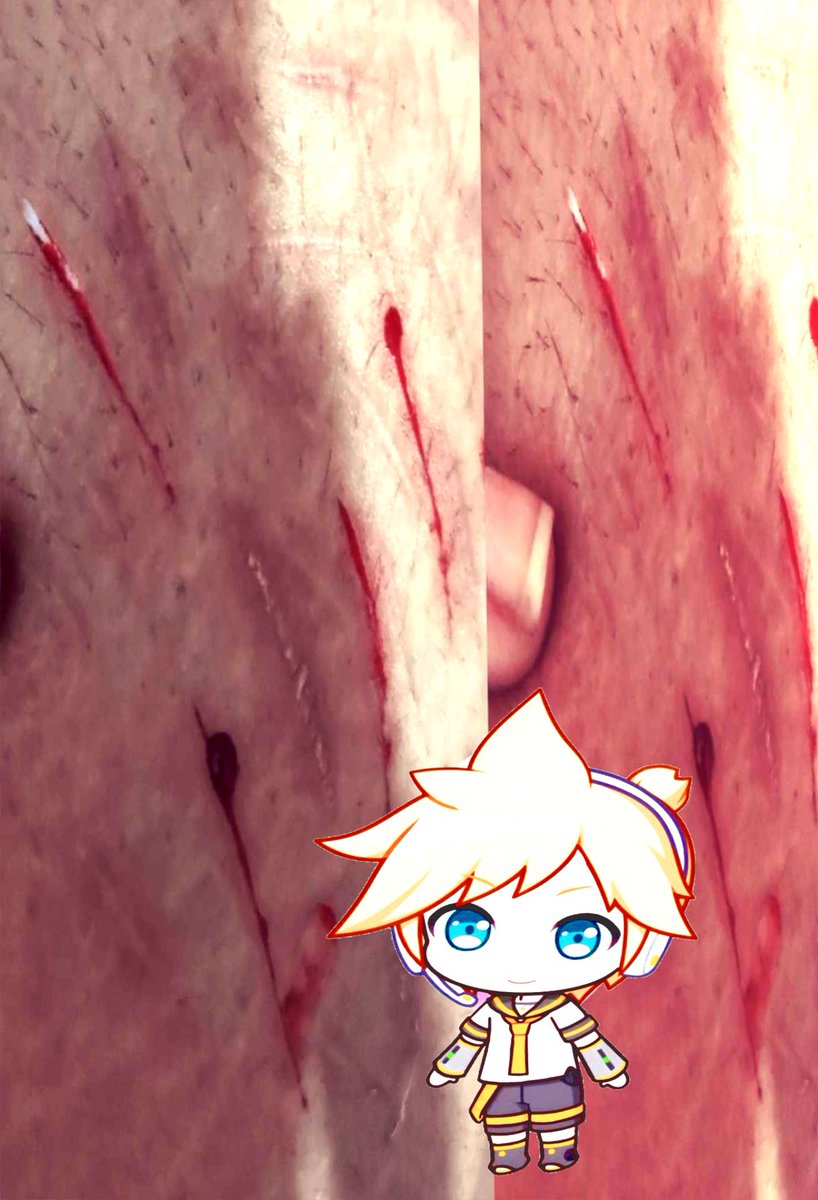 ᪖ ྀི Sora◞ཀ ᴸᵉⁿ ᵒᶠ ˢʰᵉᵈᵗʷᵗ ᵎᵎ tweet media